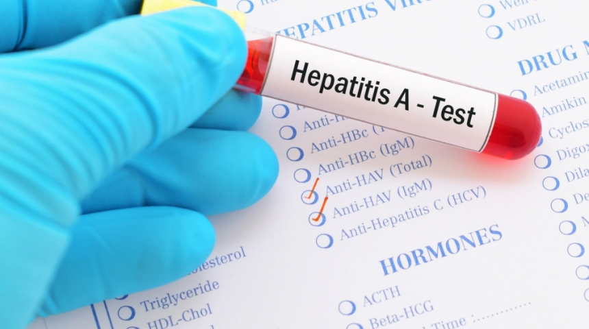 Има ли епидемичен взрив от хепатит А в Севлиево?